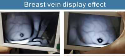 MC401 Vein Finder Easy To Use - Image 2